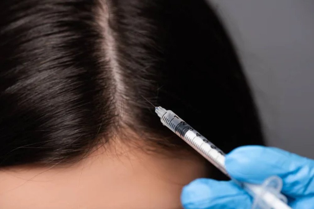 Mesotherapy Small.2 jpg